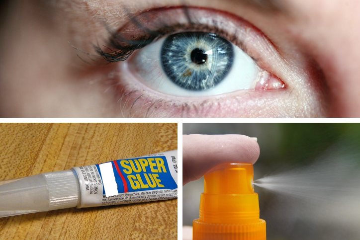A collage with a person's eye on top, a tube of superglue on the bottom left and a sprayer on the bottom right.