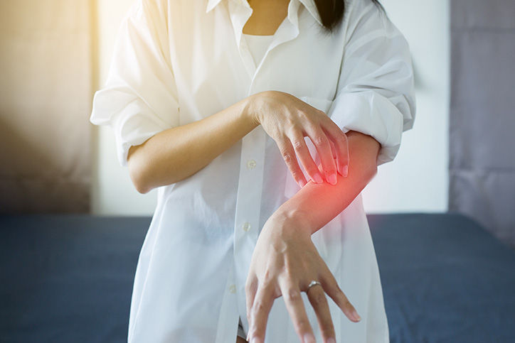 Woman with rash or papule and scratch on her arm from allergies